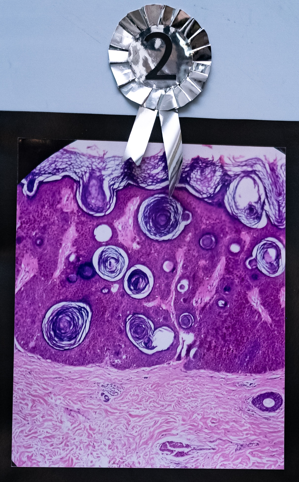 Second Place: ‘With Love, SK’ by Dr Mohamed Naseer Fathima Amra